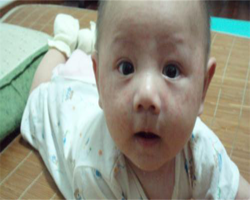 试管代孕包男孩,多囊卵巢想要小孩用什么方法治疗效果最佳？