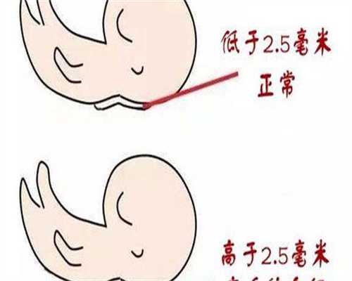 成都供卵试管婴儿生男孩医院排名？