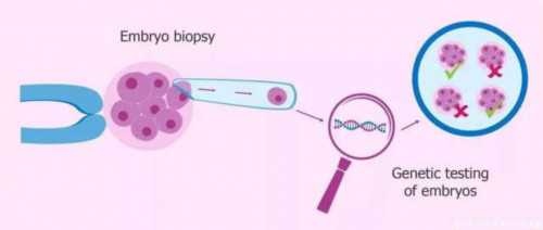 试管代孕包生儿子,卵巢囊肿肚子会变大吗？卵巢囊肿肚子会鼓吗？