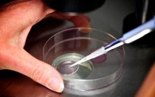 试管代孕的优势,子宫内膜薄4mm怎么办（子宫内膜薄导致月经不来）