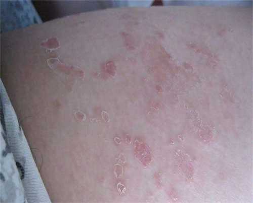 代孕口碑最好的公司_哪家做代孕最权威,宝宝得肺炎有什么症状