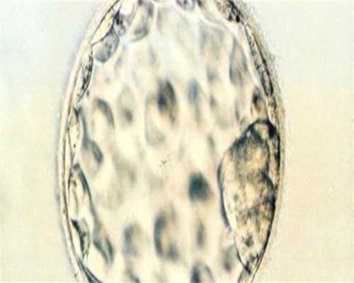 月经血为何会呈现黑褐色？