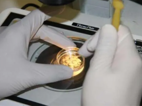 2026年少精做三代试管婴儿费用详解