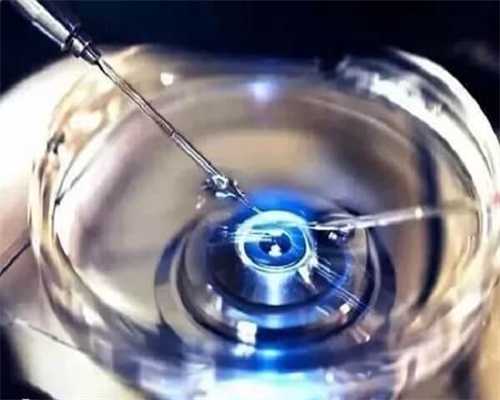 准备做试管了？试管婴儿“行话”大全请接收