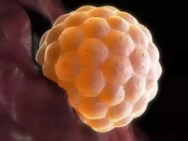 受精第三天发育成6细胞的胚胎质量很差吗？